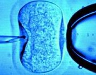 鄂尔多斯助孕机构公司三代试管服务：帮助不孕夫妻实现生育愿望