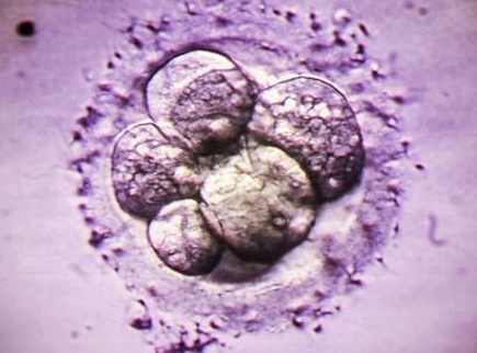 40岁女性试管婴儿促排卵前注意事项